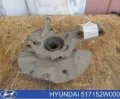 Czop (zwrotnica) przedni lewy Hyundai Santa Fe DM
